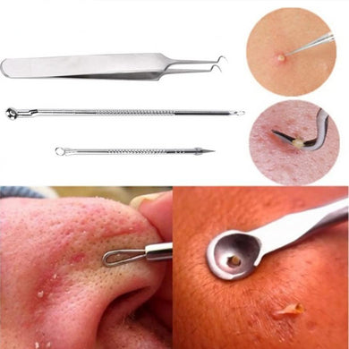 3Pcs Stainless Blackhead Facial Acne Spot Pimple Remover